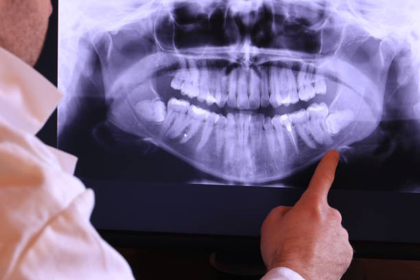 Best Pediatric Emergency Dentist in Lyons, CO