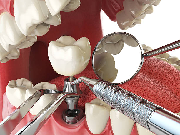 Best Emergency Dental Services for Seniors in Lyons, CO